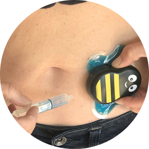 Living With Type 1 Diabetes: How to Make Daily Insulin Injections Easier and Less Painful